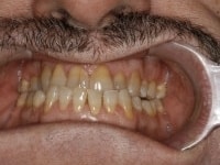 Konig Center for Cosmetic & Comprehensive Dentistry smile photos